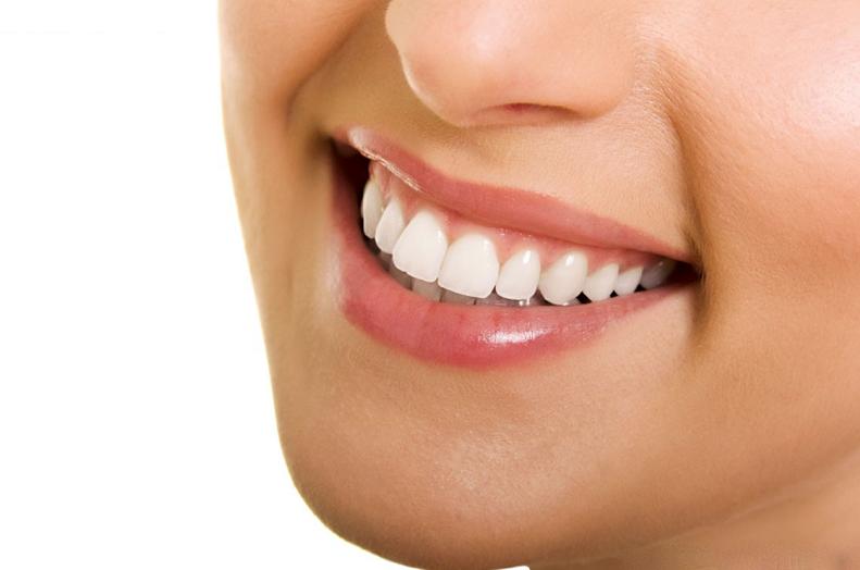 Bọc răng sứ là gì