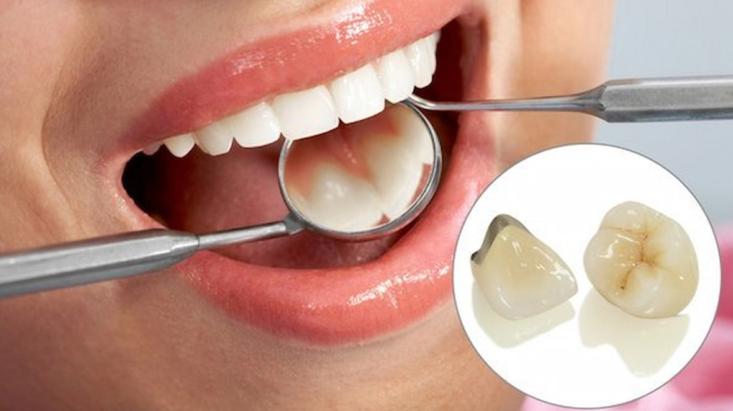Vì sao nên khám nha khoa tổng quát định kỳ