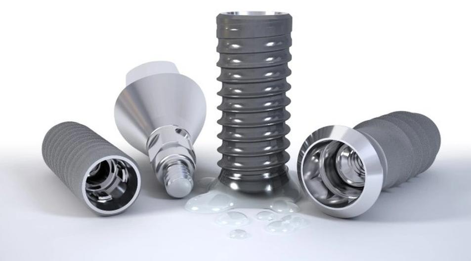 Cấu tạo của răng Implant
