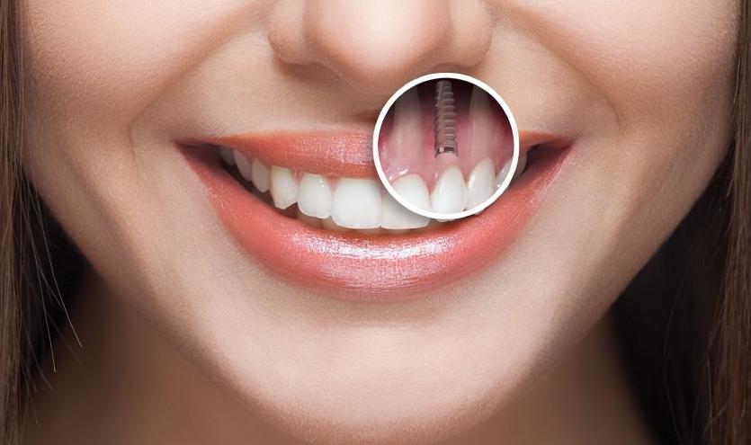 Đảm bảo tính thẩm mỹ