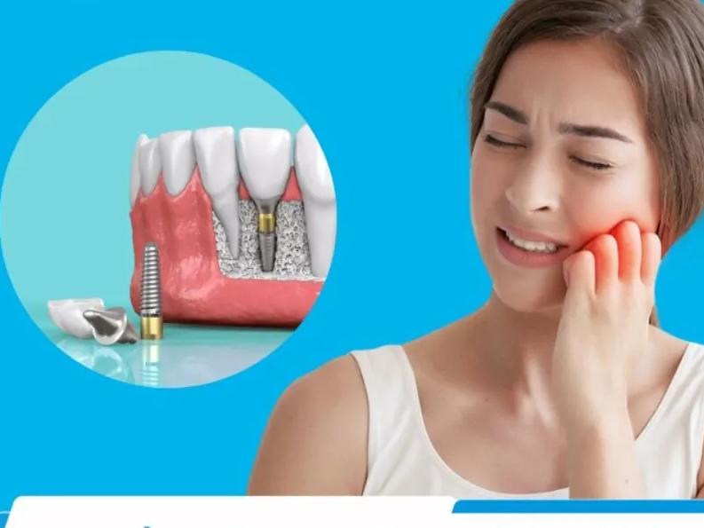 Trồng răng Implant có đau không